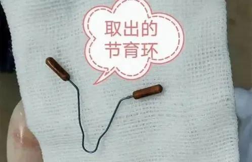 带节育环对身体有影响吗？