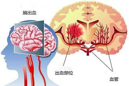 如何合理的拒绝医院的大夫让自己做CT？