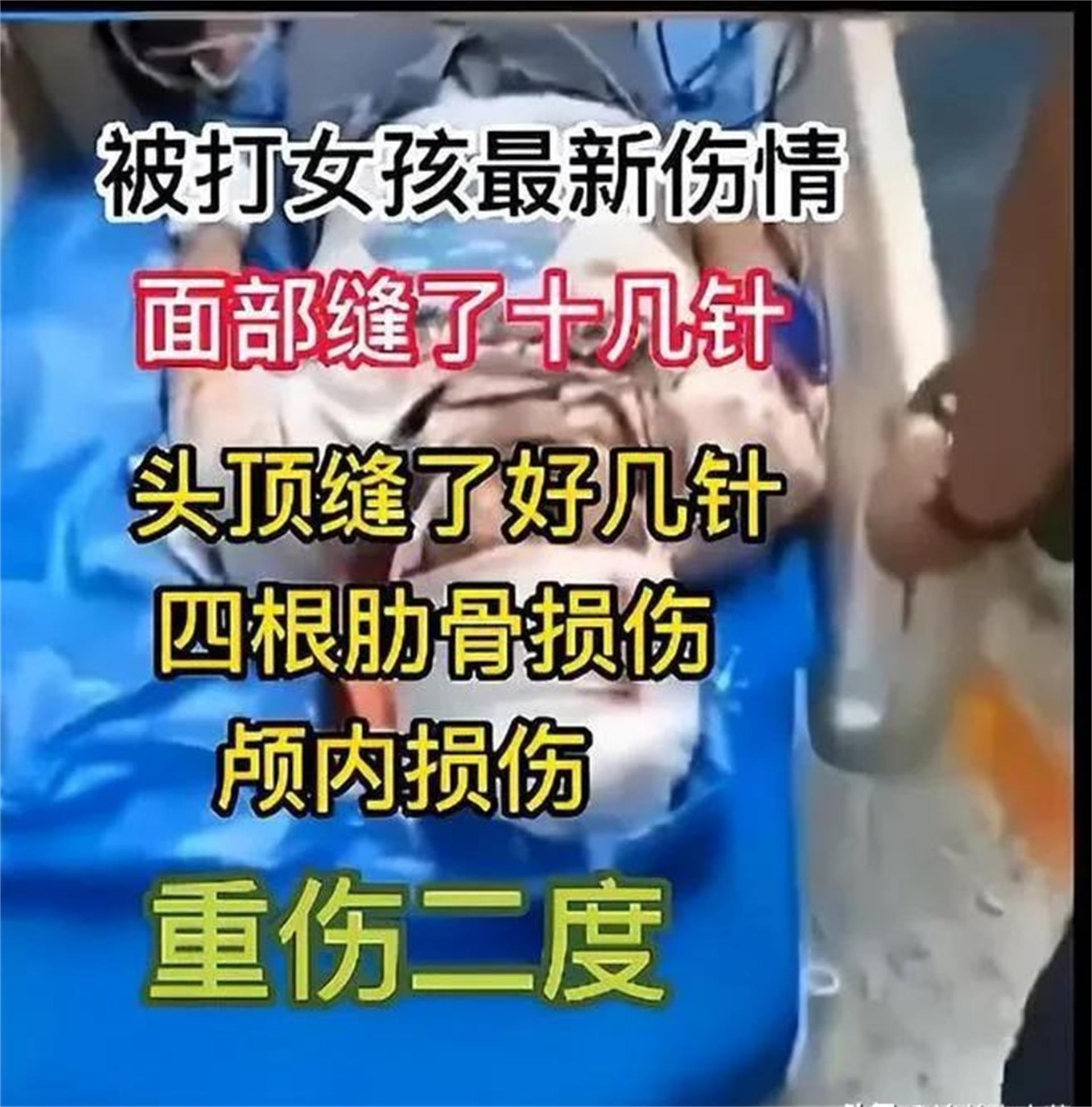 女生打人视频(巷子里的女孩怎么了？唐山烧烤店打人案视频曝光)