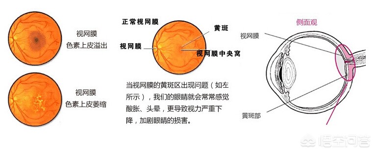 叶黄素是什么？有什么作用吗？