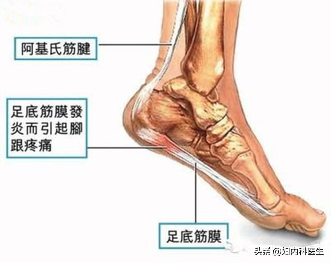 脚底板疼痛是怎么回事？